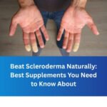 Beat Scleroderma Naturally: Best Supplements You Need to Know About