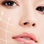 thermage treatment singapore