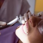 How Orthodontic Treatment for Kids Supports Dental Implants in Houston?