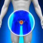 9 Male Health Problems That Are Easier to Address When You See a Male Urologist Early 