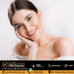 Melasma Treatment in Roorkee: Understanding Causes, Care, and Treatment Options