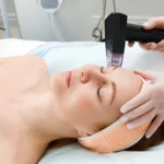 Skin Laser Treatment Johar Town Lahore: What Patients Should Know Before Booking
